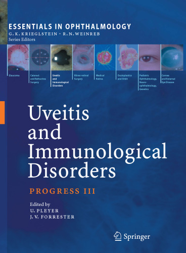 Uveitis and Immunological Disorders