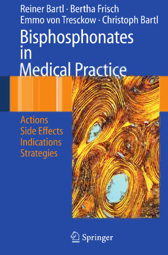 Bisphosphonates in Medical Practice: Actions — Side Effects — Indications — Strategies