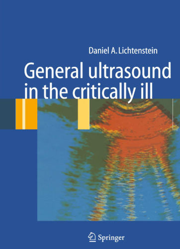 General ultrasound in the critically ill