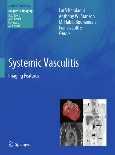Systemic Vasculitis: Imaging Features