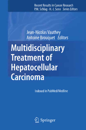 Multidisciplinary Treatment of Hepatocellular Carcinoma