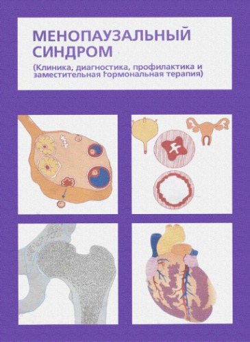 Менопаузальный синдром. Клиника, диагностика, профилактика и заместительная гормональная терапия.