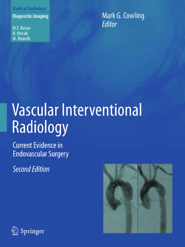 Vascular Interventional Radiology: Current Evidence in Endovascular Surgery