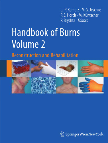 Handbook of Burns: Reconstruction and Rehabilitation Volume 2