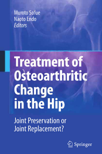 Treatment of Osteoarthritic Change in the Hip: Joint Preservation or Joint Replacement?
