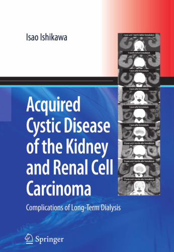 Acquired Cystic Disease of the Kidney and Renal Cell Carcinoma: Complications of Long-Term Dialysis