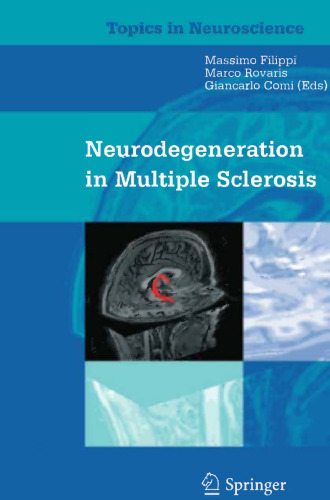Neurodegeneration in Multiple Sclerosis