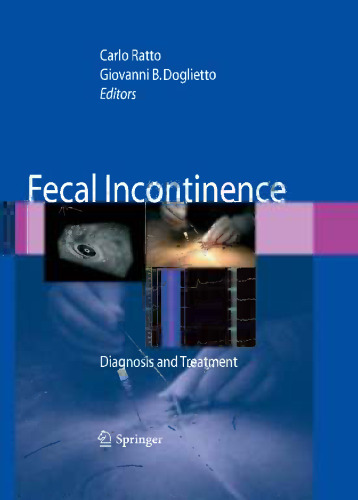 Fecal Incontinence: Diagnosis and Treatment
