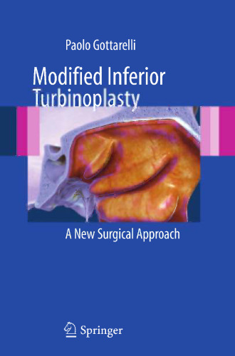 Modified Inferior Turbinoplasty: A New Surgical Approach