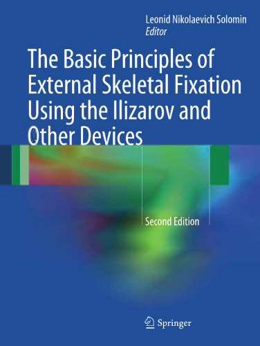 The Basic Principles of External Skeletal Fixation Using the Ilizarov and Other Devices