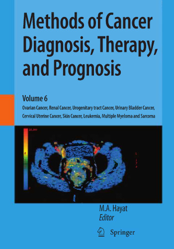 Methods of Cancer Diagnosis, Therapy, and Prognosis: Ovarian Cancer, Renal Cancer, Urogenitary tract Cancer, Urinary Bladder Cancer, Cervical Uterine Cancer, Skin Cancer, Leukemia, Multiple Myeloma and Sarcoma