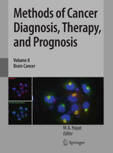 Methods of Cancer Diagnosis, Therapy, and Prognosis: Brain Cancer