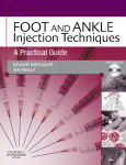 Foot and Ankle Injection Techniques. A Practical Guide