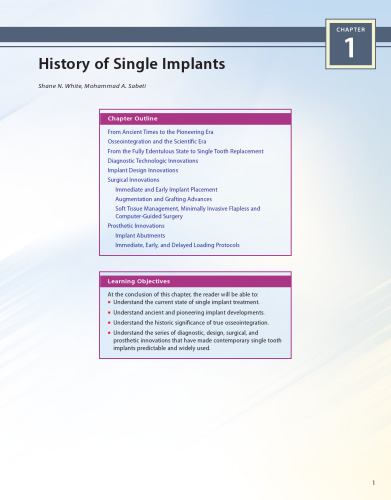 Principles and Practice of Single Implant and Restorations