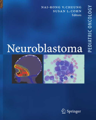Neuroblastoma