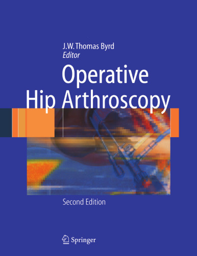 Operative Hip Arthroscopy