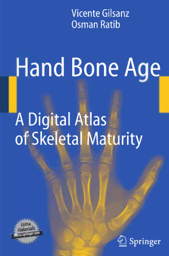 Hand Bone Age: A Digital Atlas of Skeletal Maturity