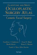 Oculoplastic Surgery Atlas: Cosmetic Facial Surgery