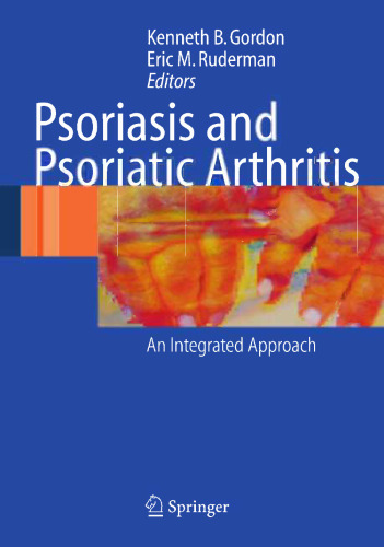 Psoriasis and Psoriatic Arthritis: An Integrated Approach