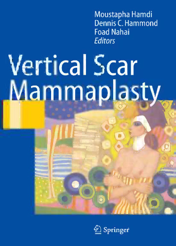 Vertical Scar Mammaplasty