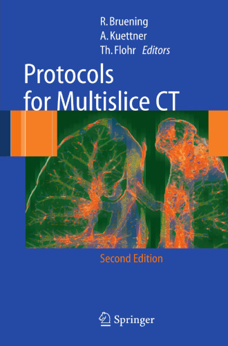 Protocols for Multislice CT