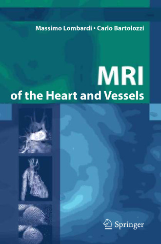 MRI of the Heart and Vessels