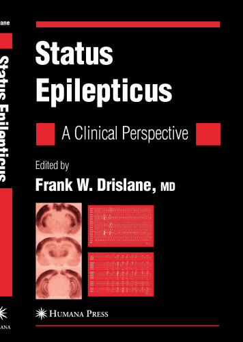 Status Epilepticus: A Clinical Perspective