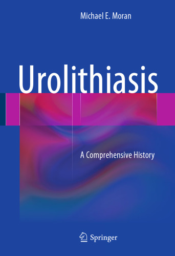 Urolithiasis: A Comprehensive History