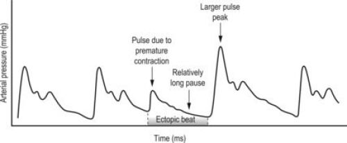 Pulse Diagnosis: A Clinical Guide, 1e