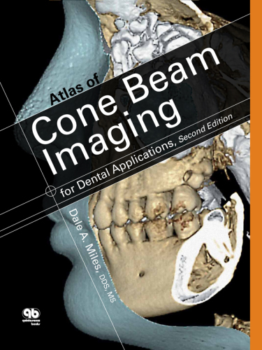 Atlas of cone beam imaging for dental applications