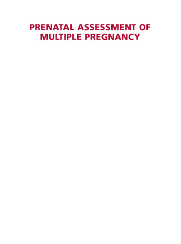 Prenatal assessment of multiple pregnancy