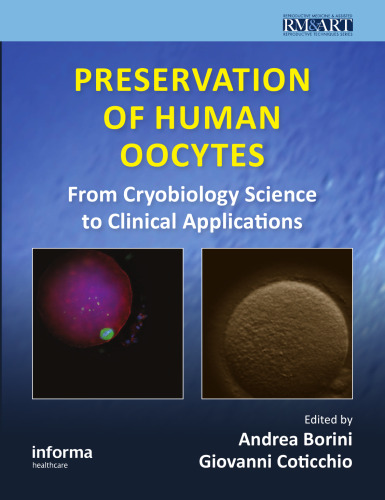 Preservation of human oocytes : from crybiology science to clinical applications