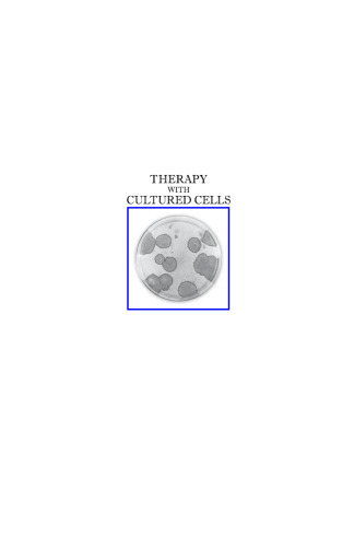 Therapy with cultured cells
