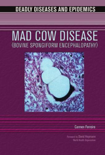 Mad Cow Disease