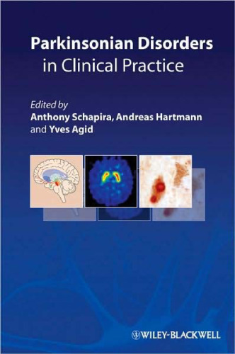Parkinsonian Disorders in Clinical Practice