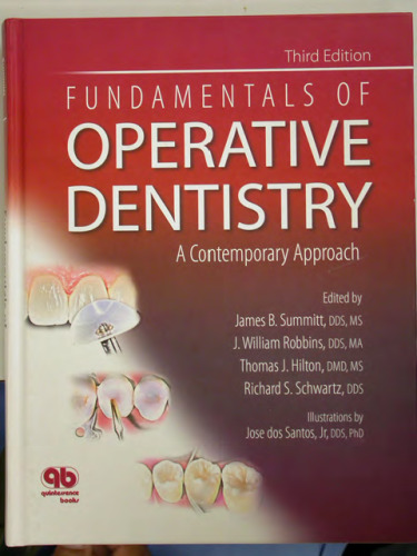 Fundamentals of Operative Dentistry: A Contemporary Approach