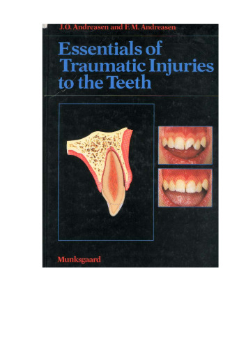 Essentials of Traumatic Injuries to the Teeth
