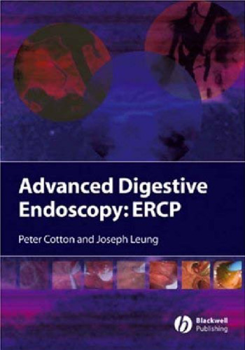 Advanced Digestive Endoscopy: ERCP
