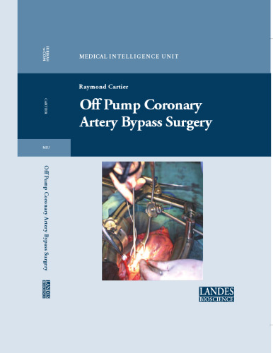 Off Pump Coronary Artery Bypass Surgery