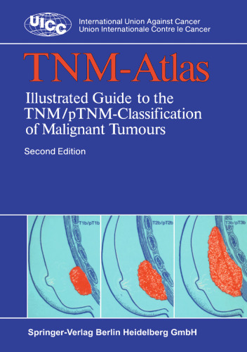 TNM-Atlas: Illustrated Guide to the TNM/pTNM-Classification of Malignant Tumours