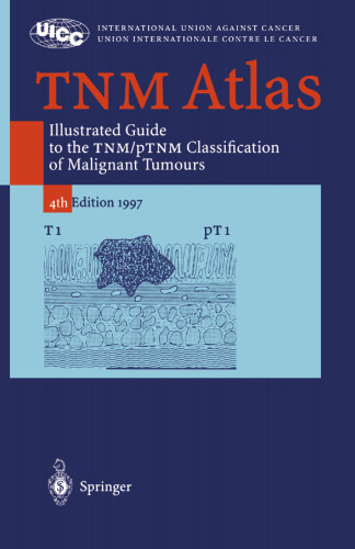 TNM Atlas: Illustrated Guide to the TNM/pTNM Classification of Malignant Tumours