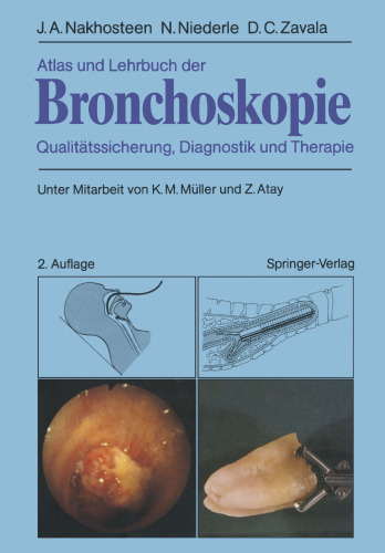 Atlas und Lehrbuch der Bronchoskopie: Qualitätssicherung, Diagnostik und Therapie