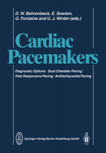 Cardiac Pacemakers: Diagnostic Options · Dual Chamber Pacing Rate Responsive Pacing · Antitachycardia Pacing