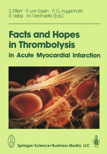 Facts and Hopes in Thrombolysis in Acute Myocardial Infarction