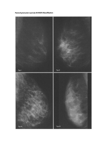 Mammadiagnostik: Komplementärer Einsatz aller Verfahren
