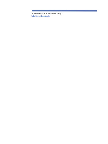 Schulterarthroskopie