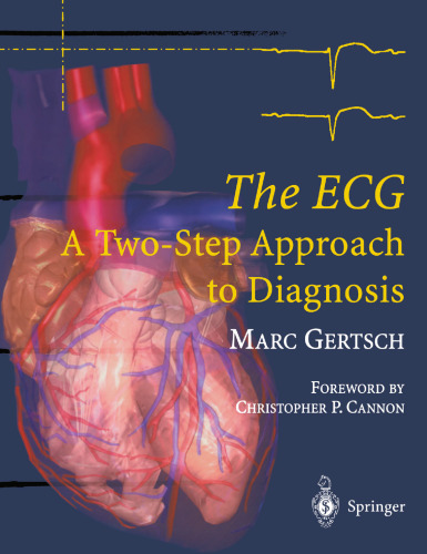 The ECG: A Two-Step Approach to Diagnosis