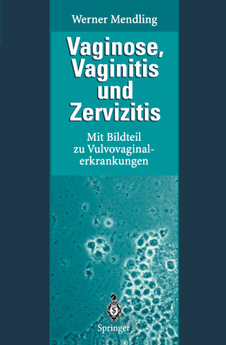 Vaginose, Vaginitis und Zervizitis: Mit Bildteil zu Vulvovaginalerkrankungen