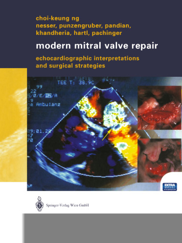 Modern Mitral Valve Repair: Echocardiographic Interpretations and Surgical Strategies