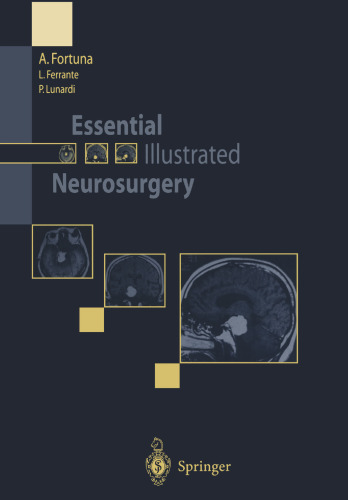 Essential Illustrated Neurosurgery